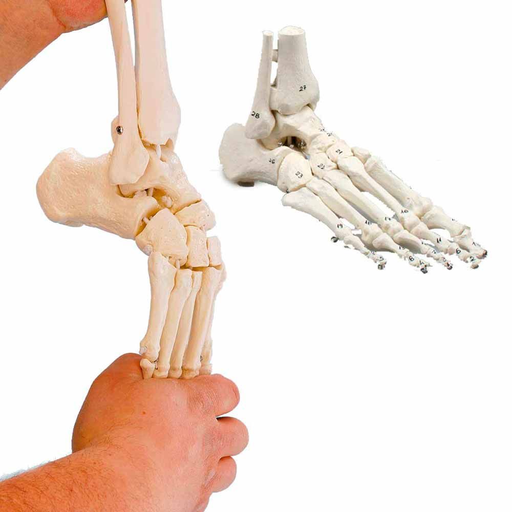 Erler Zimmer Movable Foot Skeleton/Fibula Insertion, Diff. Variants