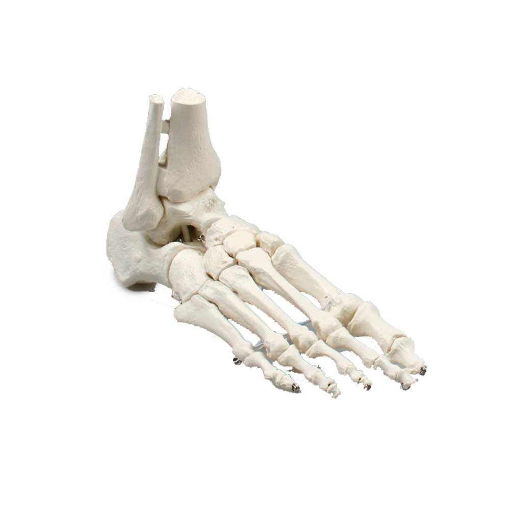 Erler Zimmer Foot Skeleton/Fibula Insertion, Different Variants