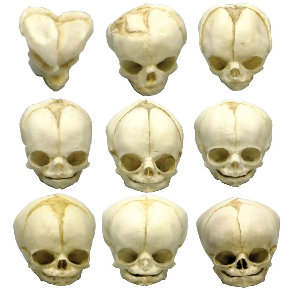 Erler Zimmer fetus skull anatomy model, different. Development Weeks