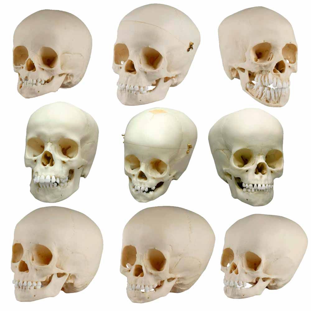 Erler Zimmer Child Skull, Different Sizes and Ages